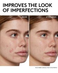 Fenty Skin Start’rs Full-Size Bundle: Oily Skin Edition